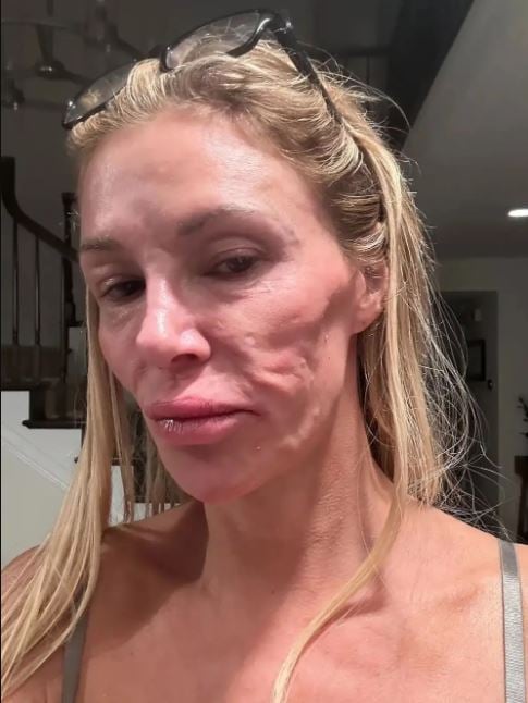 Brandi Glanville debuts new look after years-long health struggle