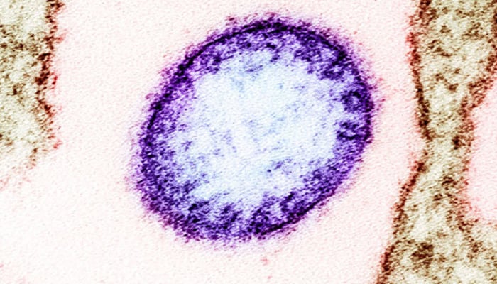 A colourised transmission electron micrograph shows a Nipah virus particle (purple) with lab-grown cells. — Harvard Medical School
