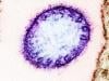 What to know about Nipah virus?