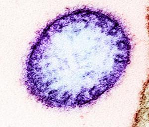 What to know about Nipah virus?
