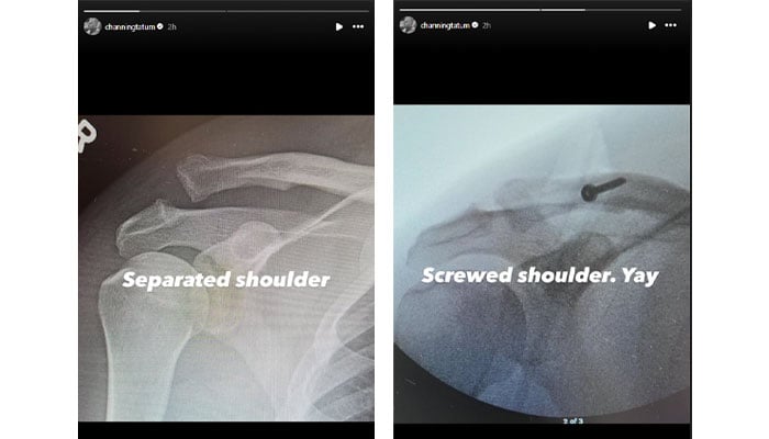 Channing Tatum prepares to undergo surgery after severe injury