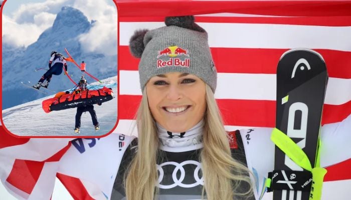 Lindsey Vonns injury history revealed after severe tibia fracture at Olympics