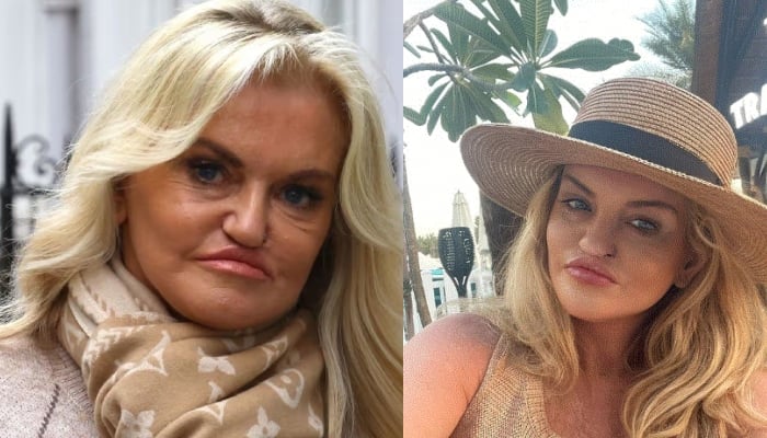 Danniella Westbrook shares radiant selfie after majory surgery