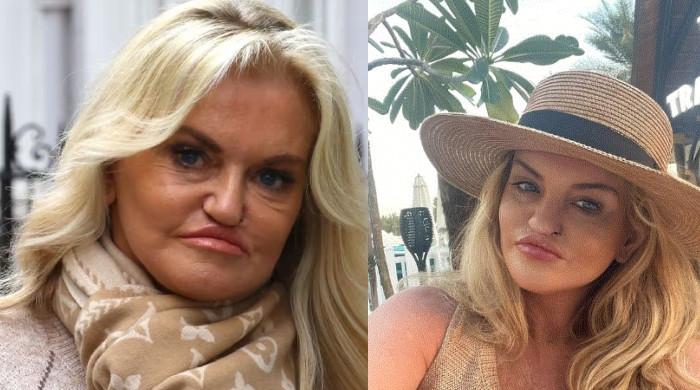 Danniella Westbrook shares radiant selfie after majory surgery