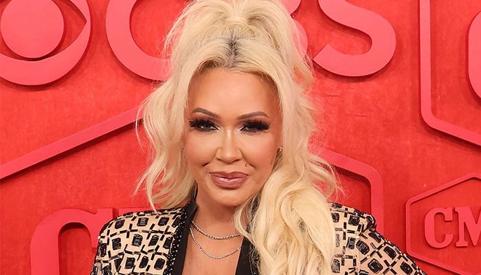 Bunnie Xo opens up about cosmetic surgery plans, recovery journey