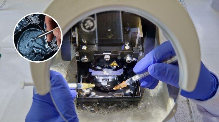 Is human brain preservation possible? New study brings it closer