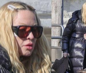 Madonna sparks concern with weird bandage during Venice outing