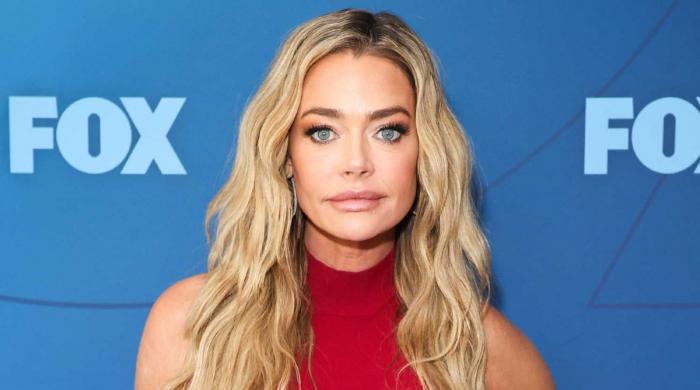 Denise Richards addresses unexpected changes after recent facelift