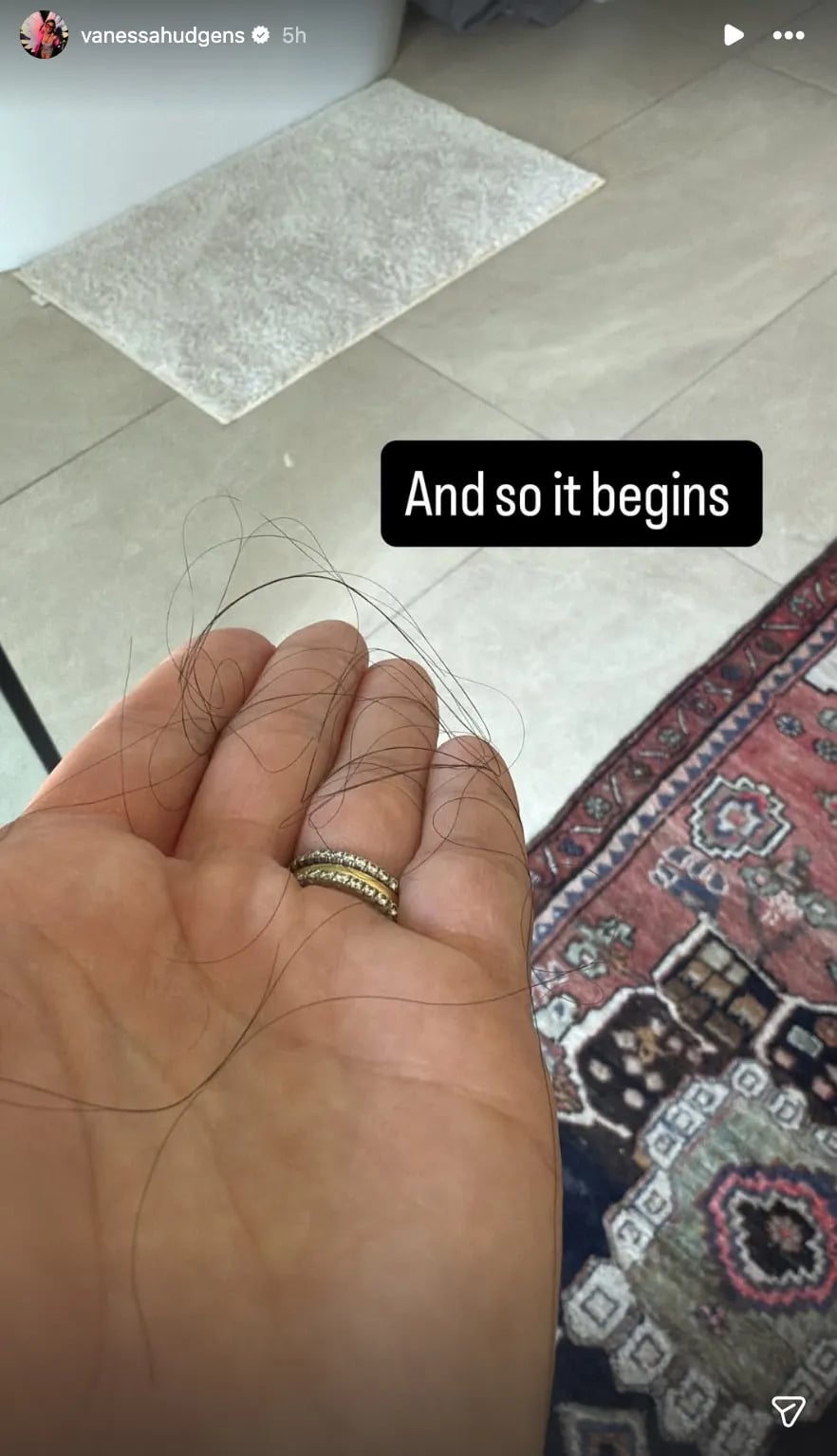 ‘High School Musical star Vanessa Hudgens gives raw look of postpartum