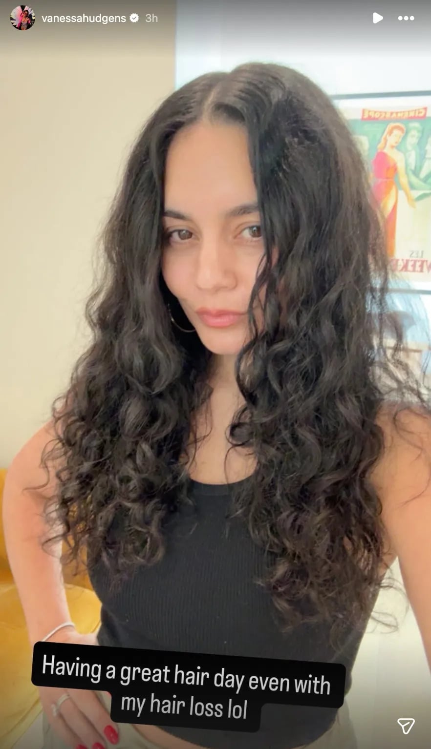 ‘High School Musical star Vanessa Hudgens gives raw look of postpartum