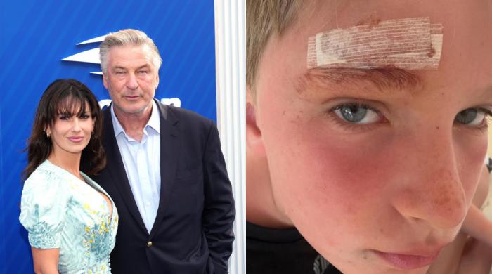 Alec, Hilaria Baldwin's son suffers scary incident amid family vacation