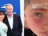 Alec, Hilaria Baldwin's son suffers scary incident amid family vacation