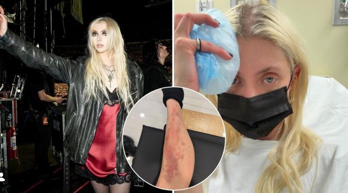 Taylor Momsen hospitalised week after getting bit by spider on AC/DC tour