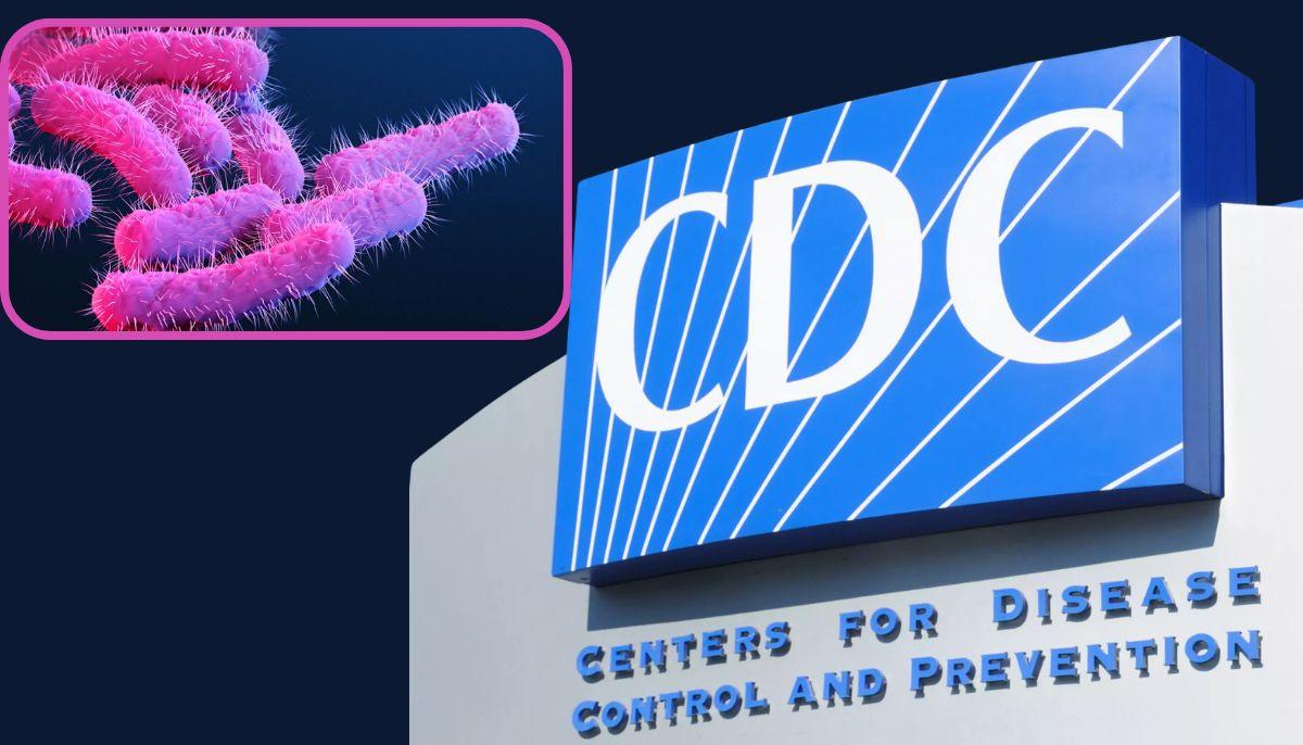 CDC issues warning over drug-resistant shigella infections across America