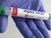 New, more transmissible Mpox variant detected in Sindh, southern Punjab