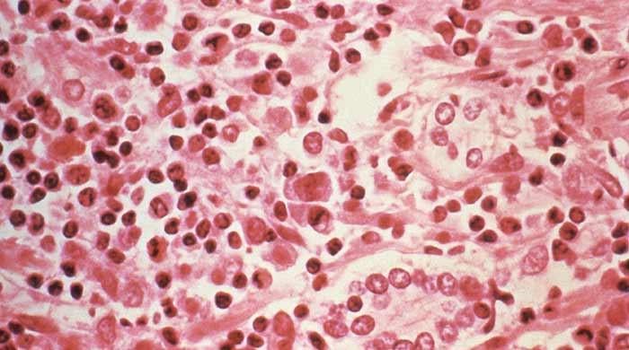 Hantavirus poses low risk to public, says WHO cruise ship deaths