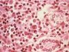 Hantavirus poses low risk to public, says WHO cruise ship deaths