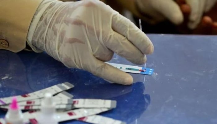 A Pakistani doctor examines the blood sample from a patient for a HIV test at a state-run hospital. — AFP/File