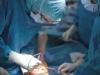 Doctors remove iron rod lodged in patient's head