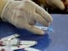 Around 20,000 HIV patients untraceable after starting treatment, NA committee told
