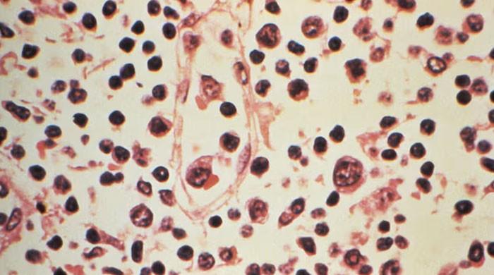 Hantavirus outbreak not like start of Covid pandemic: WHO chief