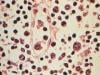Hantavirus outbreak not like start of Covid pandemic: WHO chief
