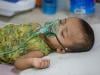 Child deaths mount from Bangladesh measles outbreak