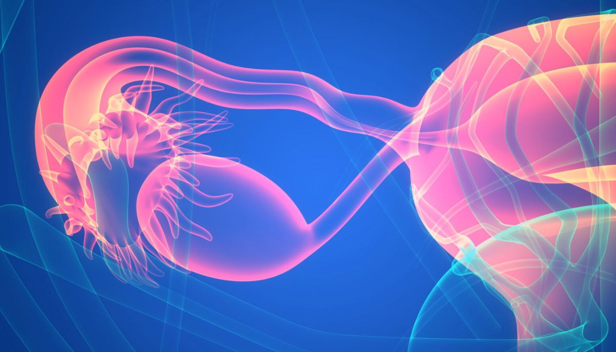 What is new name for PCOS? Here's what patients need to know