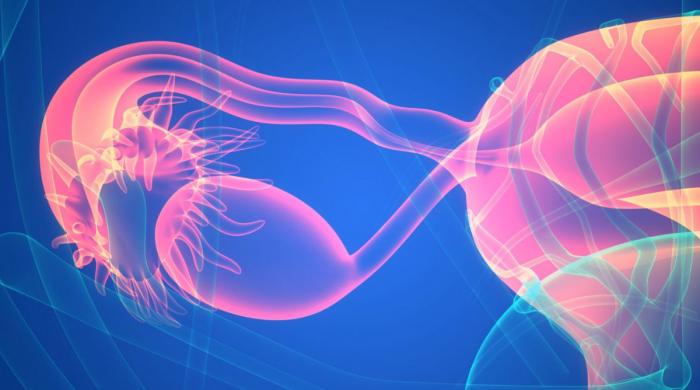 What is new name for PCOS? Here's what patients need to know
