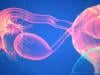 What is new name for PCOS? Here's what patients need to know