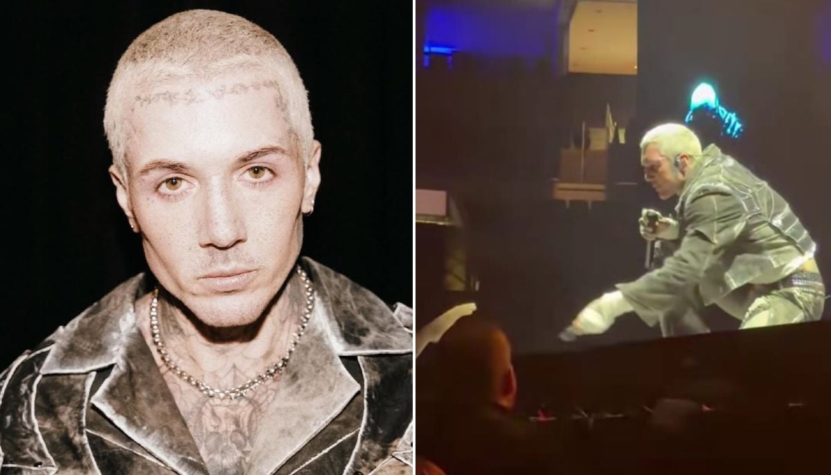 Bring Me the Horizon singer Oliver Sykes shares update after concussion