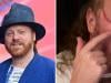 Leigh Francis suffers shocking festival injury