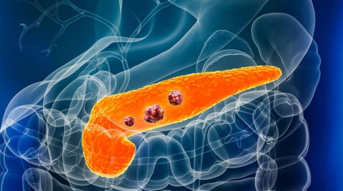 Scientists find first effective treatment for pancreatic cancer in decades