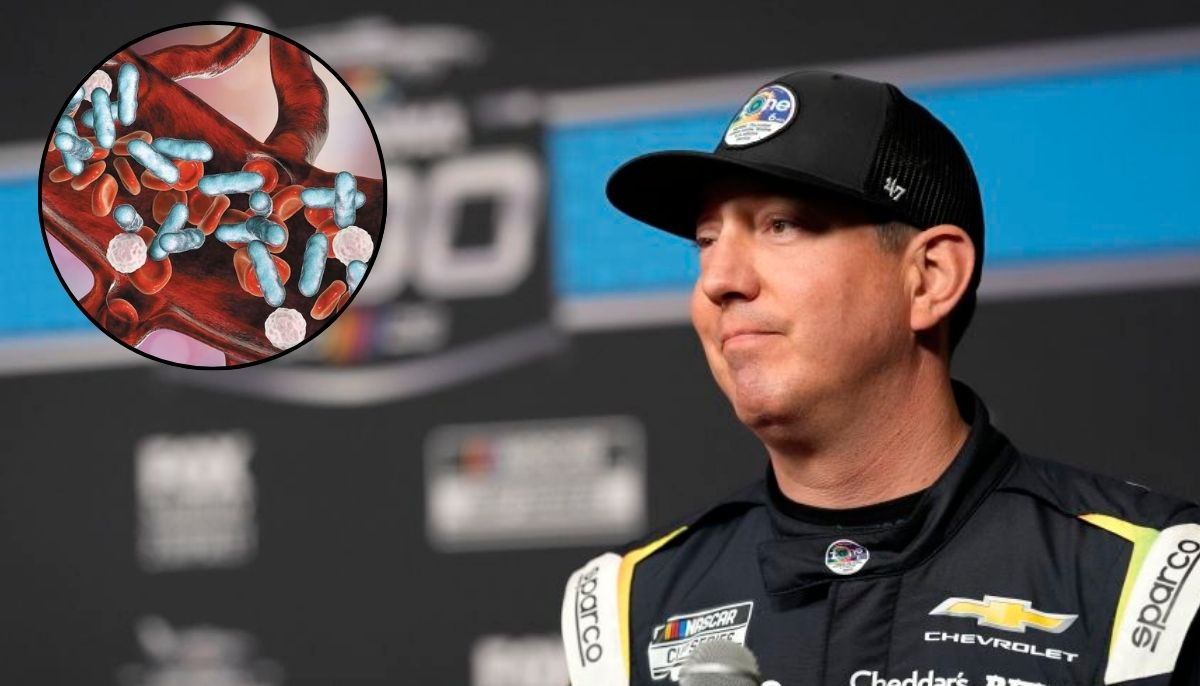 Everything to know about Sepsis: Life-threatening illness that killed NASCAR legend Kyle Busch 