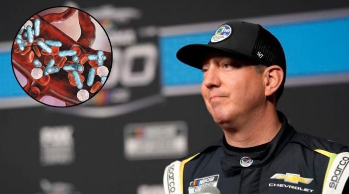 Everything to know about Sepsis: Life-threatening illness that killed NASCAR legend Kyle Busch 