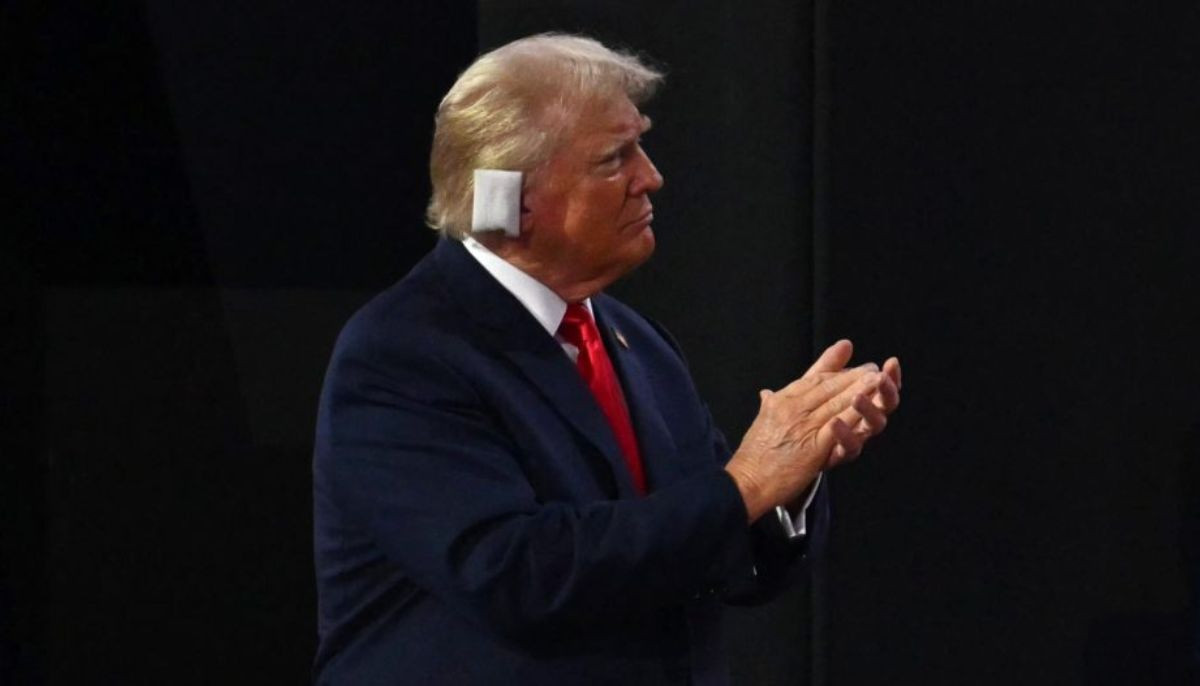 Trump's latest medical report reveals truth about bruised hands, swollen ankles