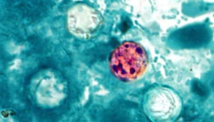 'Explosive' diarrhea parasite hits 18 states as health officials scramble to find source
