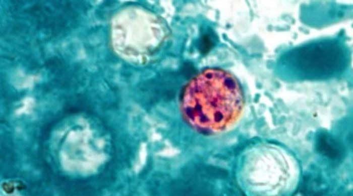 'Explosive' diarrhea parasite hits 18 states as health officials scramble to find source