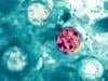 'Explosive' diarrhea parasite hits 18 states as health officials scramble to find source