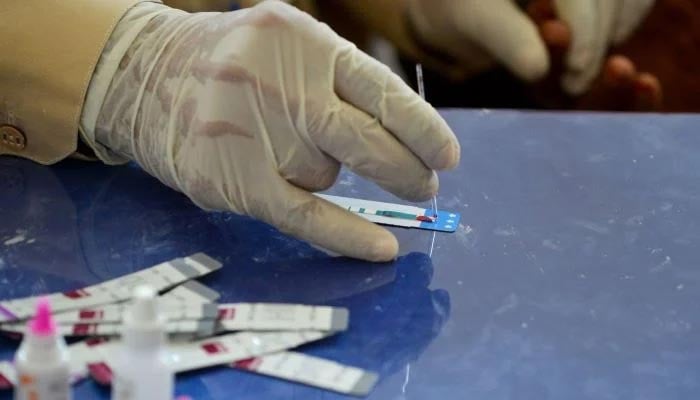 In this image taken on May 8, 2019, a doctor examines the blood sample from a patient for a HIV test at a state-run hospital. — AFP/File