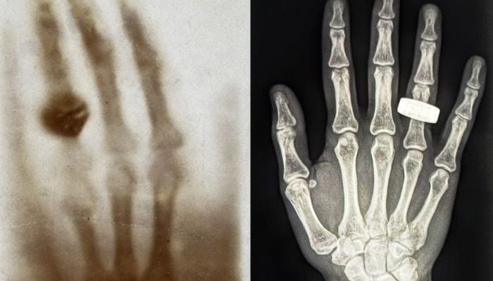 Astronauts capture first-ever x-rays in space: Here’s what it means for future