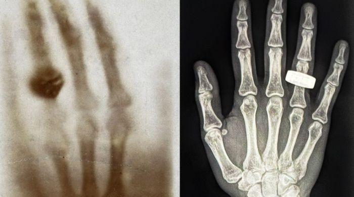 Astronauts capture first-ever x-rays in space: Here's what it means for future 