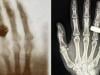 Astronauts capture first-ever x-rays in space: Here's what it means for future 