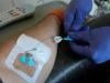 Cancer patients suffer as 40 drugs' approvals remain pending