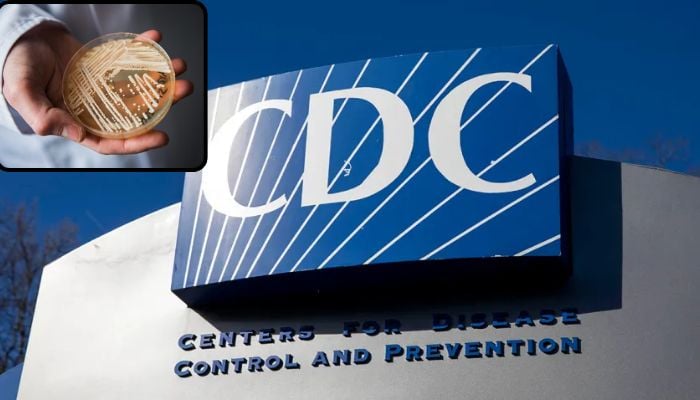 Drug-resistant fungus infects over 3,100 across US, California among hardest-hit