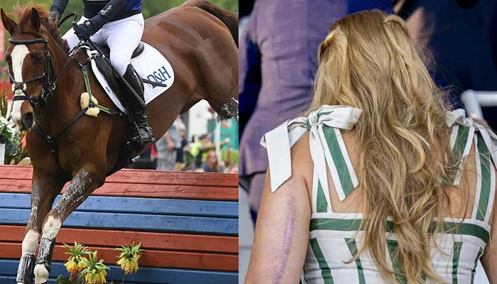 Royal Resilience: Princess Catharina-Amalia Shows Off Scar After Horse Riding Accident
