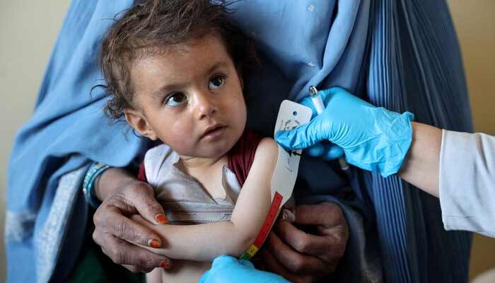 An Afghan girl looks at the doctor as he measures her upper arm at the WFP-supported Qasaba Clinic, after an increase in malnutrition cases following the return of deported Afghans, in Kabul, Afghanistan, January 7, 2026.— Reuters