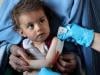One million Afghan children suffering 'life-threatening' malnutrition: UN