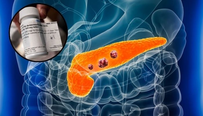 Daraxonrasib wins FDA approval for advanced pancreatic cancer