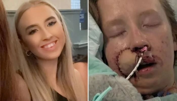 Woman mauled by dog she’d known since puppyhood faces years of surgery